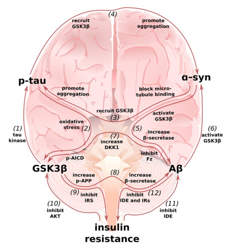 Multi-loop model of Alzheimer disease